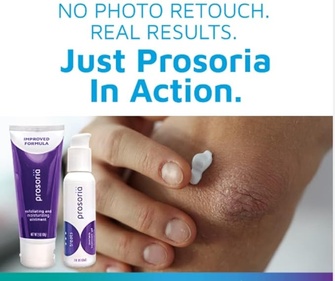 Prosoria Treatment System Single Kit – 2oz | Powerful Psoriasis Relief with Salicylic Acid, Turmeric, Shea Butter & Vitamins | Gel & Ointment for Scaling, Flaking, Dryness, Itching & Redness Relief