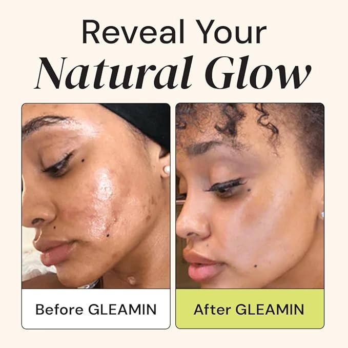 Gleamin Brightening Duo – Vitamin C Clay Mask & Advanced Brightening Moisturizer for Dark Spots, Uneven Tone & Glowing Skin