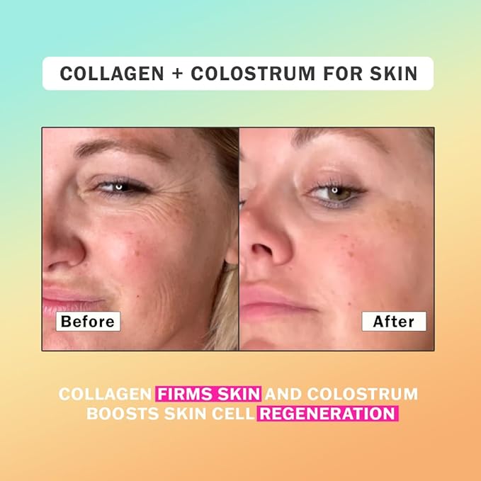 Colostrum & Collagen Peptides Powder with Biotin, Hyaluronic Acid & Vitamin C | Gut Health & Bloating, Immune Support, Hair, Skin & Nails Supplement | Unflavored | 30 Servings