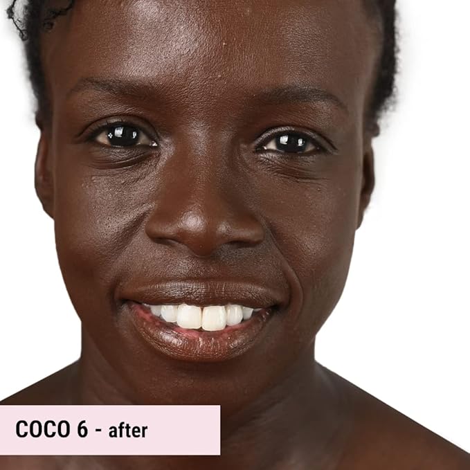 Loves-You-Back 3in1 Mineral Powder Foundation (COCO 6) | Designed for acne-prone, sensitive skin | Lightweight Coverage for hyperpigmentation + marks | Concealer, Foundation + Powder