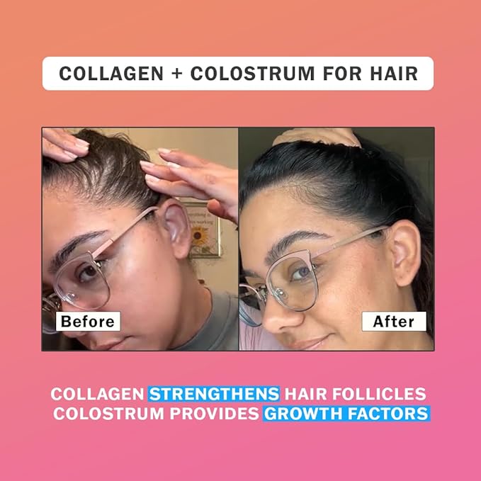 Colostrum & Collagen Peptides Powder with Biotin, Hyaluronic Acid & Vitamin C | Gut Health & Bloating, Immune Support, Hair, Skin & Nails Supplement | Unflavored | 30 Servings