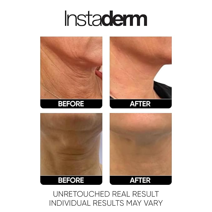 Neck and Décolleté Firming Cream – Tightening & Lifting Treatment for Crepey, Wrinkles, sagging Skin & Vertical Lines. Anti-Aging Peptide Formula to Boost Hydration & Collagen in the Skin.