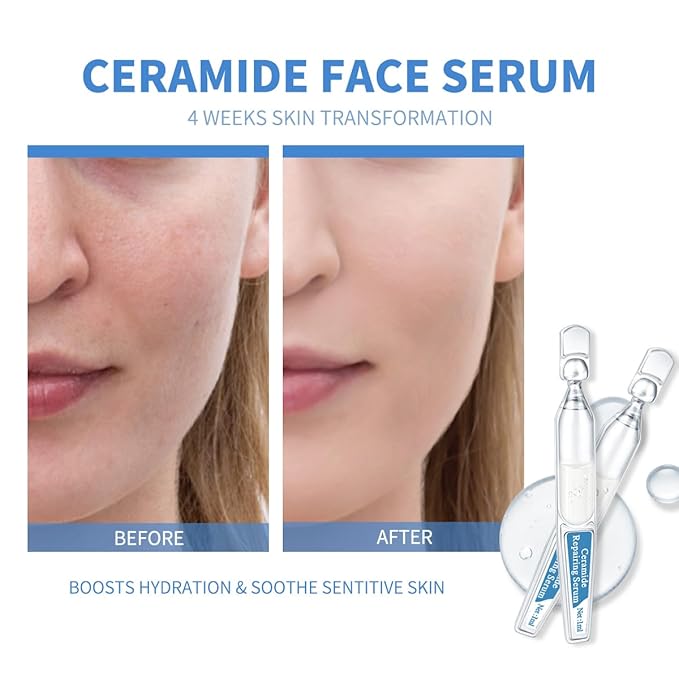Ceramide Ampoule Serum with Hyaluronic Acid, Peptide, Hydrating & Anti Aging, Skin Barrier Repair Face Serum for Dry and Sensitive Skin, 30 Pcs/Box