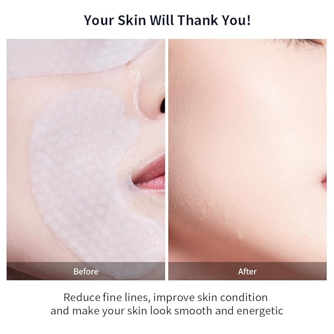 REAL DEEP HYALURONIC ACID ANTI-WRINKLE MASK - Multi-Zone Micro-Pressure Face Mask for Eyes, Cheeks & Jawline - SMAS Lifting Technology with Supro-Energy Complex & Cyto HA - 5ea