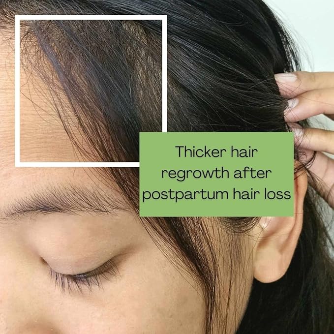 Blooming Mane - Hair Growth Serum, Natural Hair Oil, Promotes Hair Growth 2 fl oz