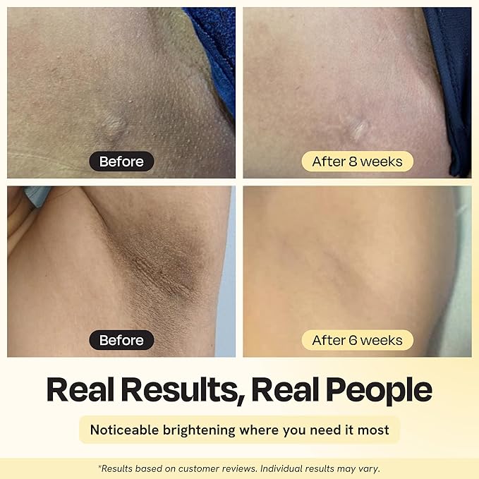 Gleamin Illuminating Intimate Serum with Vitamin C, 4% Niacinamide & Alpha Arbutin, Brightening Hyperpigmentation Treatment for Body - Underarm, Intimates Areas & Inner Thigh Lightening, 1 Fl oz