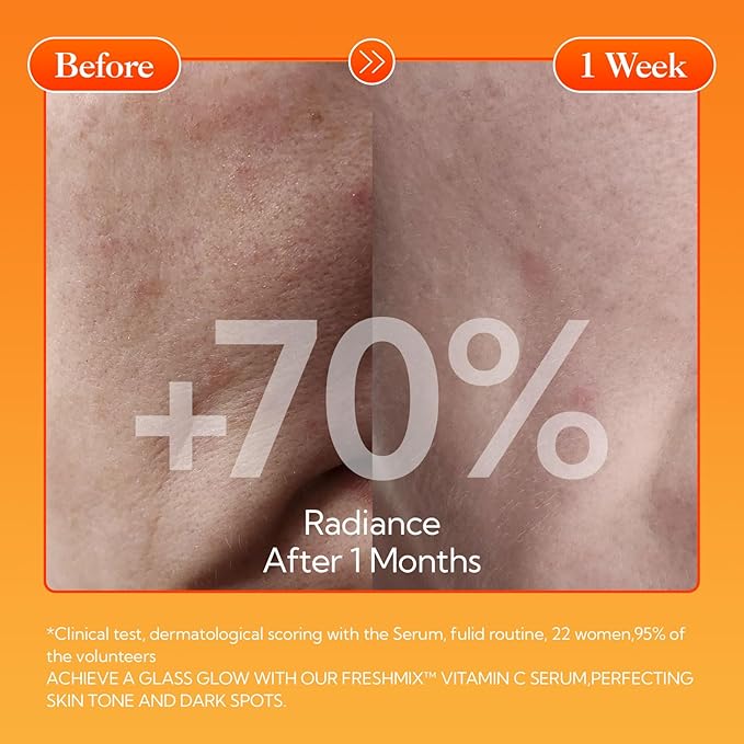 LANBENA Revolutionary Vitamin C Serum for Face, Illuminating Fcae Serum With Niacinamide, Brightening Anti-Aging Essence for Sensitive Skin, Non-Greasy, Reduces Dark Spots & Wrinkles (1.05 Oz)