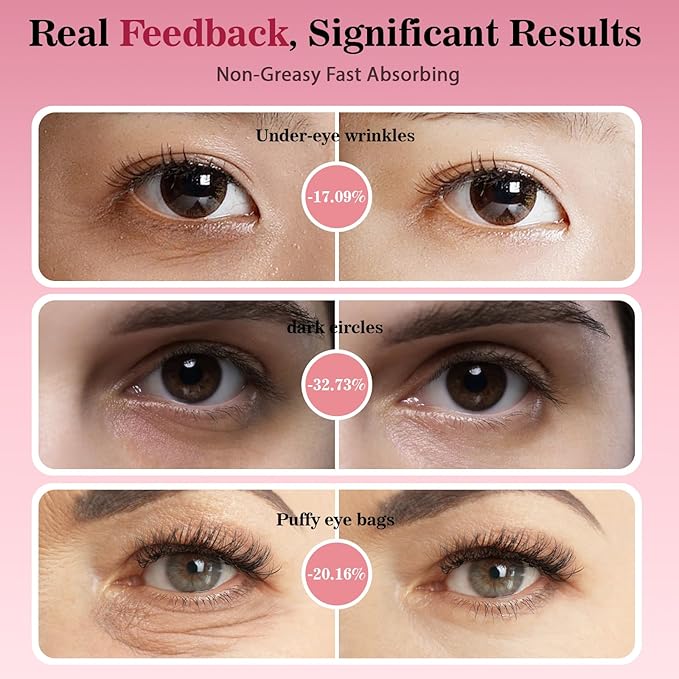 Anti Aging Retinol Eye Cream - Firming Moisturizing Calming Botanicals for Daily Eye Zone Care to Strengthen Skin Barrier & Reduce Fatigue Signs for Balanced Wellness in Routine Life Women Doctor 15ml