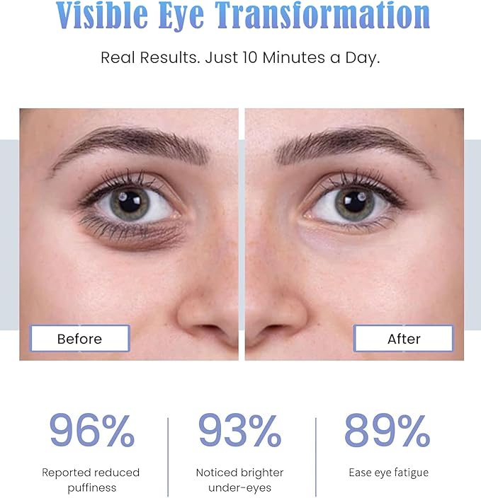 Under-Eye Red Light Therapy Glasses for Women,10 Min Daily Use for Digital Eye Strain Eye Bag Dark Circles Puffiness,39g Ultra Lightweight, Rechargeable