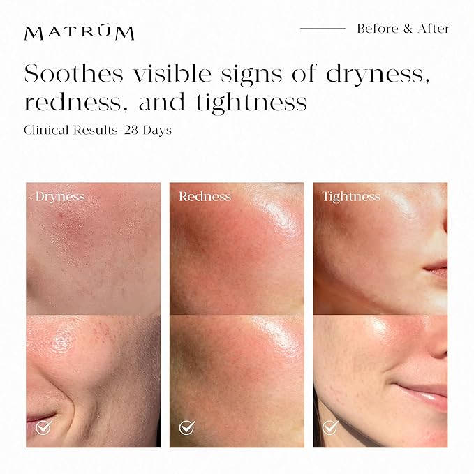 MINI Discovery & Travel Size Set - 4 x Mini Face oil for Deep Repair & Radiance Boost &Firming