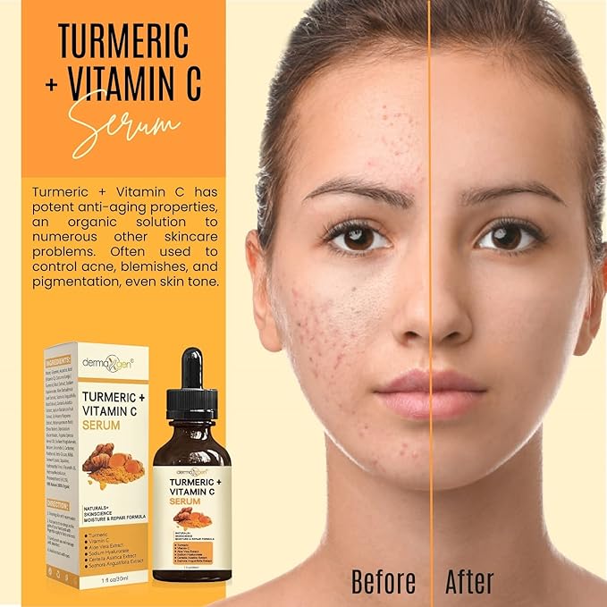 Turmeric and Vitamin C Anti-Aging facial serum, PURE ORGANIC Reduce Wrinkles, Improve Blemishes and Acne, Skin firming and Intensive Moisturizing & hydrating Serum for all skin Types (1 fl oz))