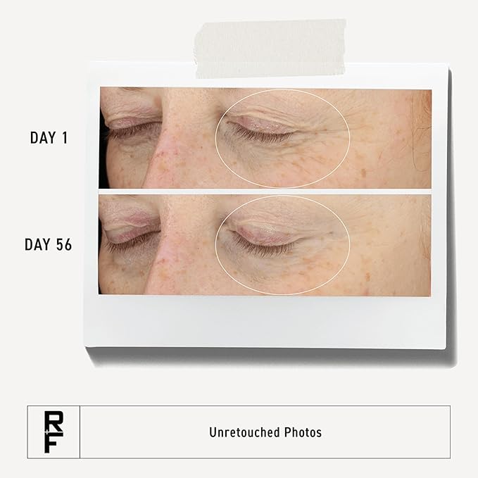 RODAN + FIELDS Redefine Eye Cream | 15 ml | Vitamin C & F Moisturizer for Hydrated, Radiant Eyes | Supports Younger Looking Eyes | Smooths Puffiness
