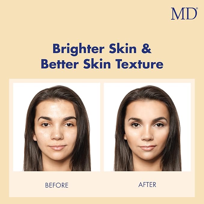 MD Ultimate Vitamin C Serum – Anti-Aging Face Serum with L-Ascorbic Acid for Dark Spot Reduction, Fine Line & Wrinkle Care, and Collagen Support for Radiant Skin