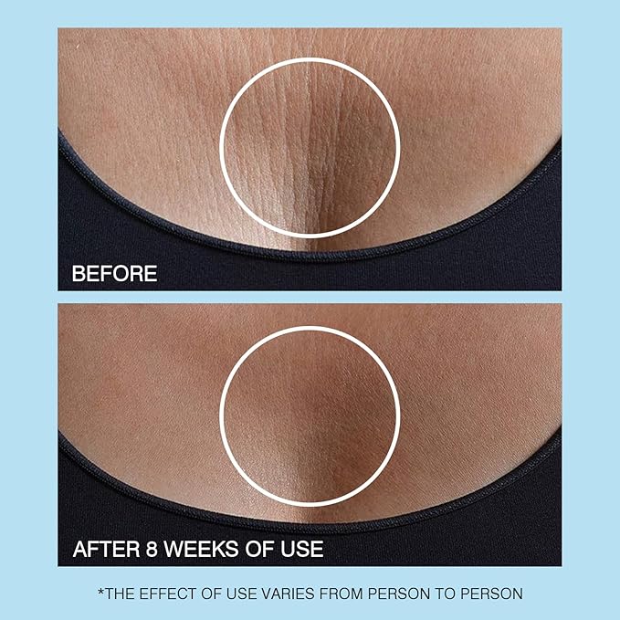 Retinol Neck Cream, Hyaluronic Acid and Caffeine Enriched Neck Firming Cream to Minimize Fine Lines & Dullness - 3-in-1 Moisturizing Cream for Neck, Chest and Face (50 ml/1.7 oz)