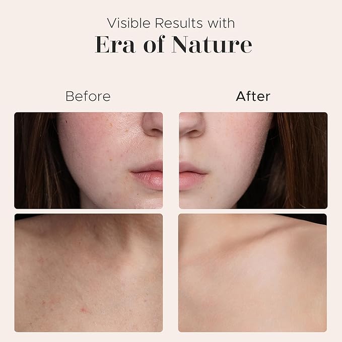 era of nature Mango Whipped Body Cream for Women 8oz - Lightweight Whipped Lotion with Pure Mango - Non-Greasy Body Butter Cream Lotion & Balm Moisturizer for Face, Hair & Dry Skin, Vegan Skincare