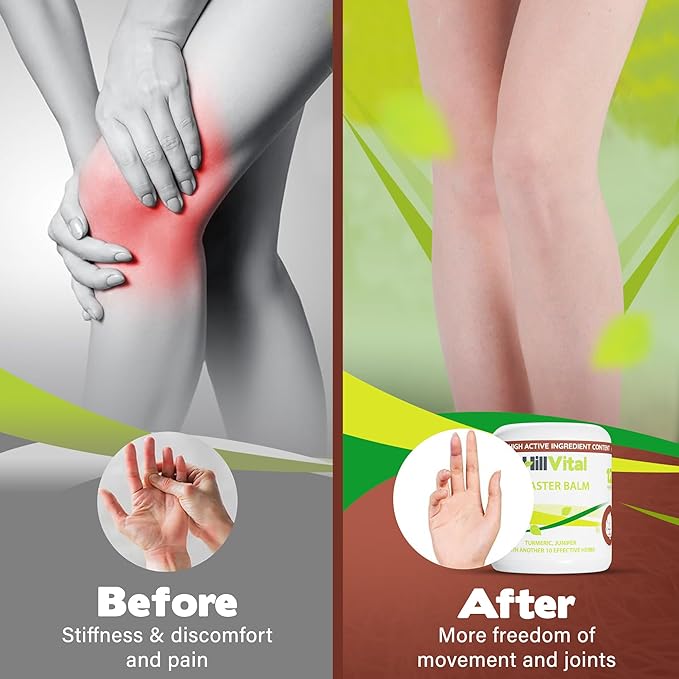 HillVital Rheumatic, Arthritis Pain Gel Extra Strength - Potent Rheumatoid Arthritis Pain Relief Cream, Turmeric-Arnicar Gel Ache Reliever for Sore Muscle, Relief for Joints, Tendons, Natural Solution