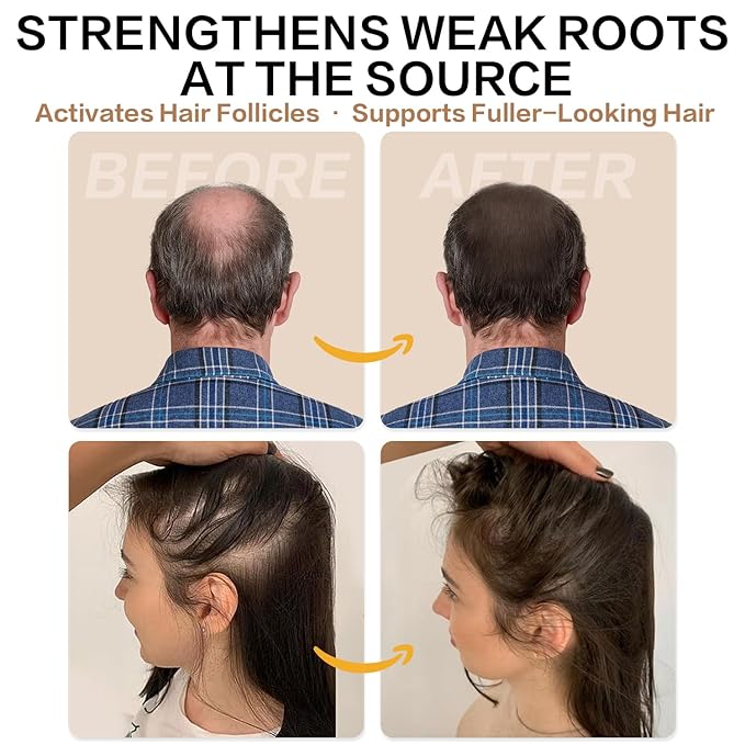 Root Activator Shampoo for Men and Women – Rosemary & Boiton Hair Growth Shampoo for Thinning Hair, Hair Loss & Scalp Health – Natural Herbal Formula with Cooling Sensation – Sulfate-Free – 10.1 fl oz