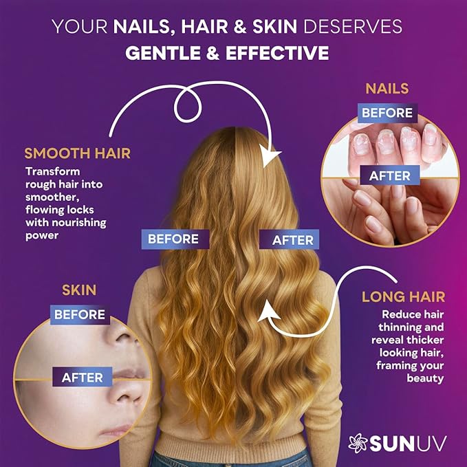 SUNUV Biotin 10000mcg with Collagen & Keratin - 80000mcg Hair Growth Vitamins for Women & Men,Skin & Nails Support - Hyaluronic Acid & Vitamins B1,B2,B3,B5,B6,B9,B12 -Made in USA-90 Capsules