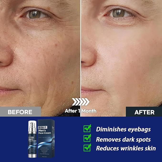 6 in 1 Face Cream for Men – Anti Aging Men’s Moisturizer with Collagen, Hyaluronic Acid and Shea Butter – Daily Skin Care – Reduce the Look of Eye Bags, Dark Circles and Puffiness – 1.76 fl oz (1)