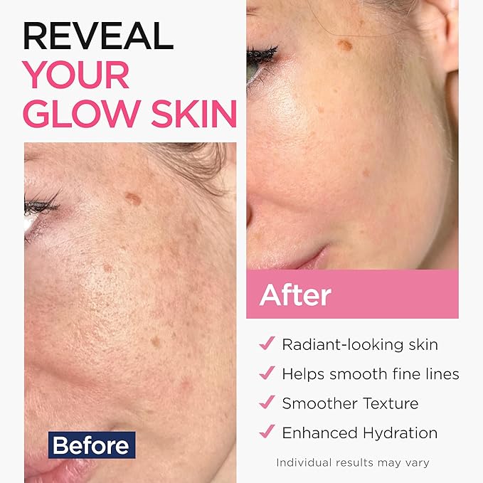Retinol Serum for Face with Hyaluronic Acid, Vitamin E & Aloe Vera Anti-Aging Serum - All Skin Types - Supports Even Tone - Day and Night - Made in USA - 1 Oz