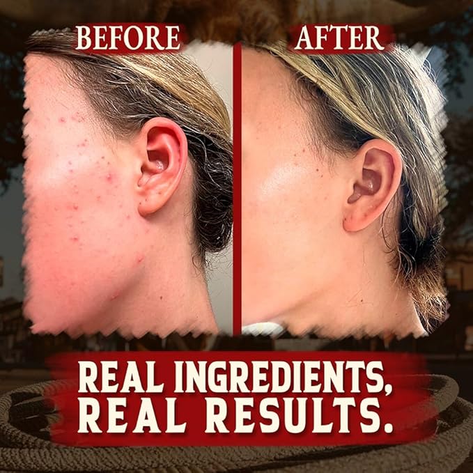 Organic Beef Tallow for Skin - 4 OZ (Pack of 3) โ Grass Fed Beef Tallow for face + Body โ US-Made Whipped Tallow and Honey Balm Moisturizer for Dry and Sensitive Skin, Eczema, Rosacea (No Additives)