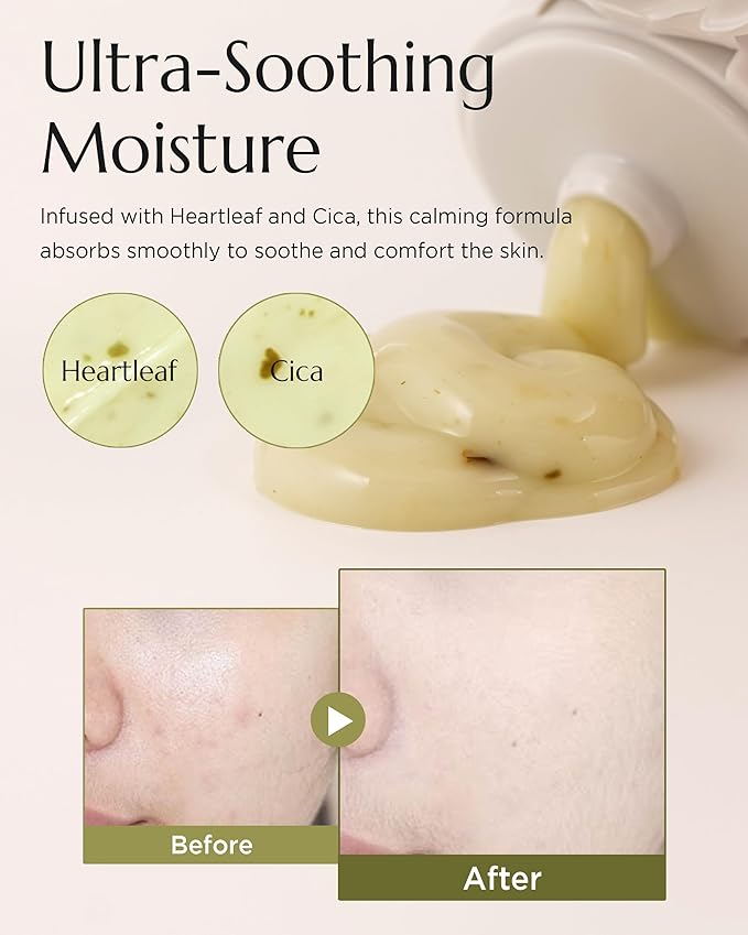 CHICHO Herb Infused Calming Cream - Korean Face Moisturizer with 68.8% Heartleaf & 6-Cica Complex - For Sensitive Acne Prone Skin, Vegan Clean Formula, 2.37 fl.oz.