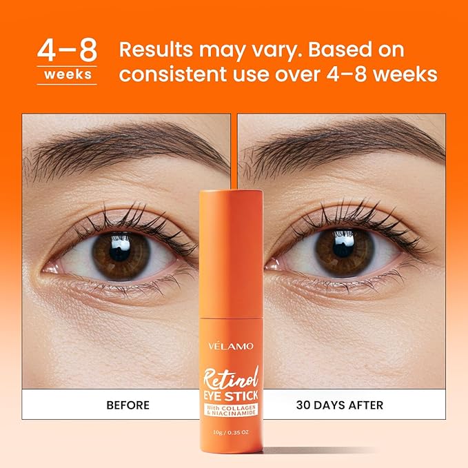 VELAMO ADVANCED Retinol Eye Balm Stick: Made in Korea, Travel Essentials, Upgraded 8-in-1 Formula with Collagen, Niacinamide & Peptides – Under Eye Cream for Dark Circles, Puffiness & Wrinkles 0.7oz