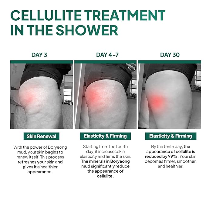 Anti Cellulite Mud Scrub Body Wash, Gentle Exfoliating, Improves Skin Texture, Provides a Smoother Look, 5.07 Fl Oz (1)