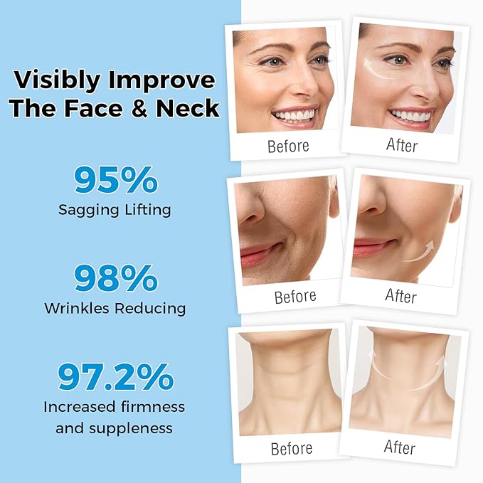 OUKEYA Retinol Cream for Face,Wrinkle for Women, Anti-Aging Moisturizer, Neck Firming & Décolleté, Moisturizer Face Cream, Day Night with 5% Hyaluronic Acid