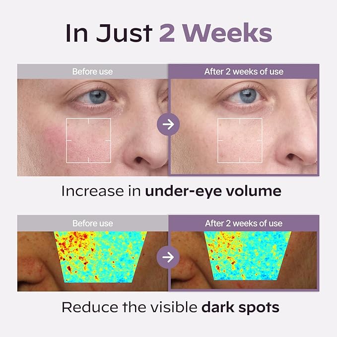 Superform Galvanic Booster, 1min booster for ageless, anti-aging and firming pocket booster, glow on the go