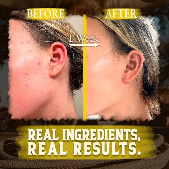 Organic Beef Tallow for Skin - 4 OZ (Citrus) โ Grass Fed Beef Tallow for face + Body โ US-Made Whipped Tallow and Honey Balm Moisturizer for Dry and Sensitive Skin, Eczema, Rosacea (No Additives)