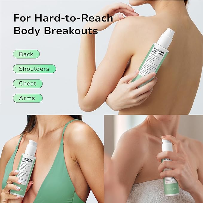 Back and Body Acne Treatment Spray: 2% Salicylic Acid & Tea Tree Oil Bacne Spray for Clear, Soothe & Moisturize - Effective for Men, Women, Teens with Back, Shoulder, Arm, and Chest Acne