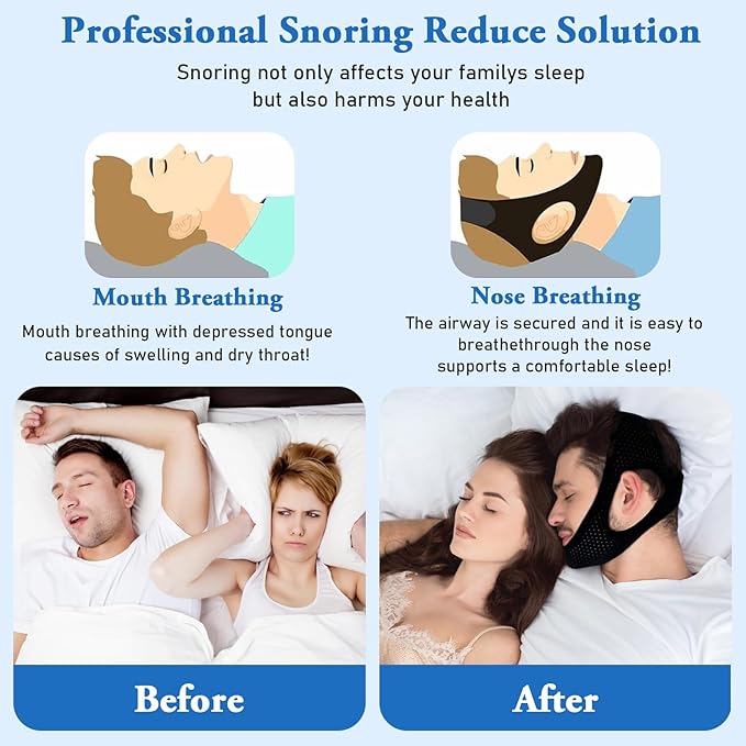 2 Pack Anti Snore Chin Strap for Sleeping, Jaw Tape Mouth Snoring Sleep Devices Stopper Cpap Users Breathing Head Mouthpiece Solution to Keep Closed Mandibular Advancement Reducing Men Women Aids