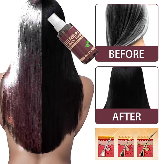Herbal Gray Hair, Hair Darkening Conditioner Spray, Herbal Hair Coloring Spray, Hair Coloring Essence for 4 Weeks Gradual Results,Natural Hair Darkening Conditioner for Color Revival (2pcs)