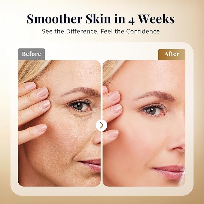 Anti Aging Serum, Retinol Serum for Face with Squalane and Hydrolyzed Collagen, Improve Fine Lines and Hydrate Skin, Wrinkle Retinol for Various Types of Skin Women/Men