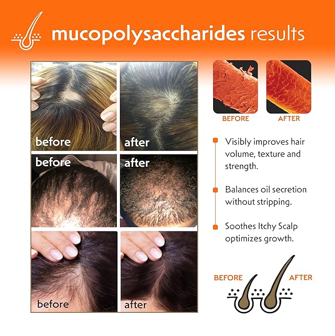 Regrowth Hair & Scalp Revitalizer Leave-In Spray, Biotin, Tea Tree & Mucopolysaccharides (natural polysaccharide/sugar polymer), 8 oz.