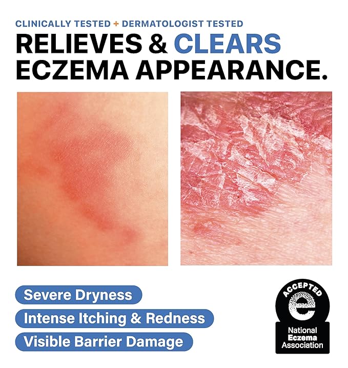 Eczema Relief & Repair Moisturizer for Face & Body. Hydrating & Nourishing Eczema Cream for Very Dry, Sensitive, Itchy Skin. National Eczema Association Accepted. Vegan, Made in USA, 94g