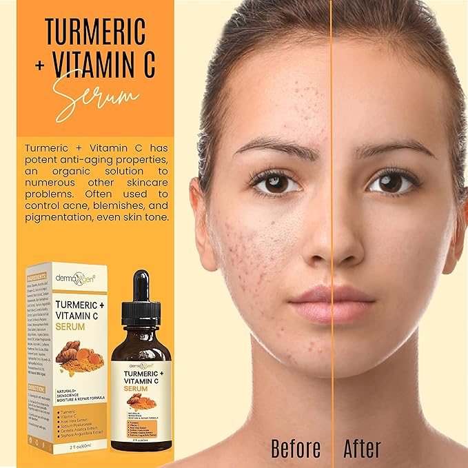 Turmeric Serum for Face + Glow-Boosting Vitamin C Serum –Organic Moisturizer for Acne, Dark Spots & Clear Skin– Boosts Hydration for Dry & Tired Skin – Anti-Aging Formula for Glowing Skin, 2 FL OZ