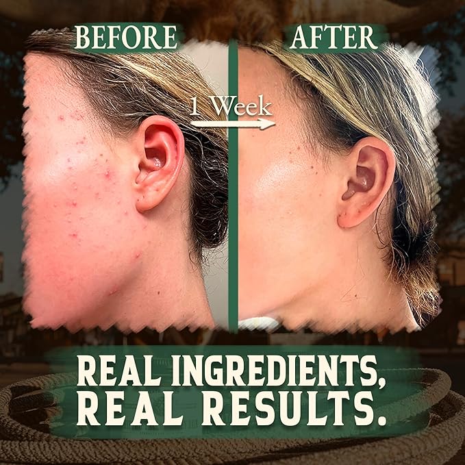 Organic Beef Tallow for Skin -2OZ (Eucalyptus, Concentrated) โ Grass Fed Beef Tallow for face + Body โ US-Made Tallow and Honey Balm Moisturizer for Dry & Sensitive Skin,Eczema,Rosacea (No Additives)