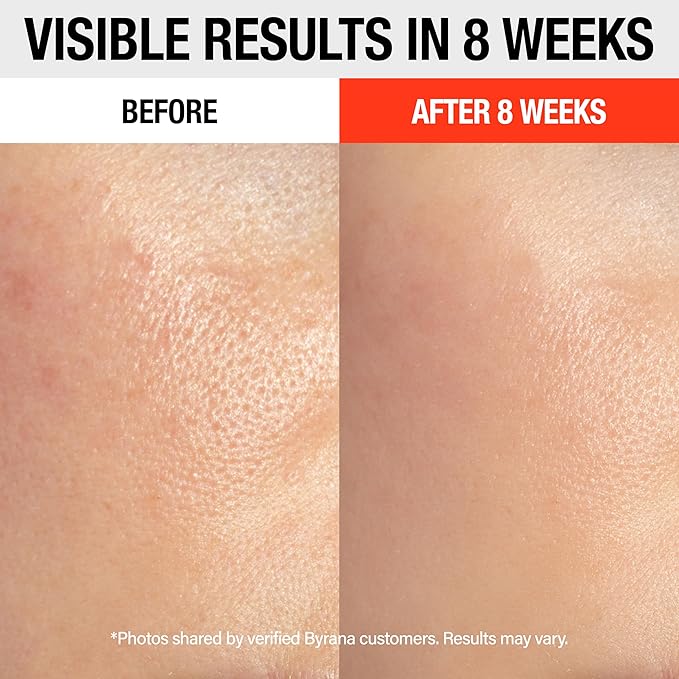 Vitamin C Brilliant Glow Face Serum – Korean Anti Aging Skincare with THD Ascorbate, Matrixyl 3000, Ferulic Acid & Ginseng – Visibly Reduces Dark Spots, Uneven Tone, Fine Lines & Wrinkles