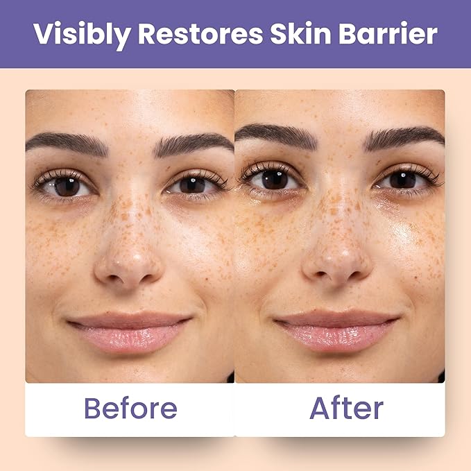 Patchology Skin Remedy Barrier-Boosting Sheet Mask – Single Use Face Mask with Ectoin, Ceramides & Probiotics – Hydrates, Protects & Nourishes – Suitable for Sensitive & All Skin Types