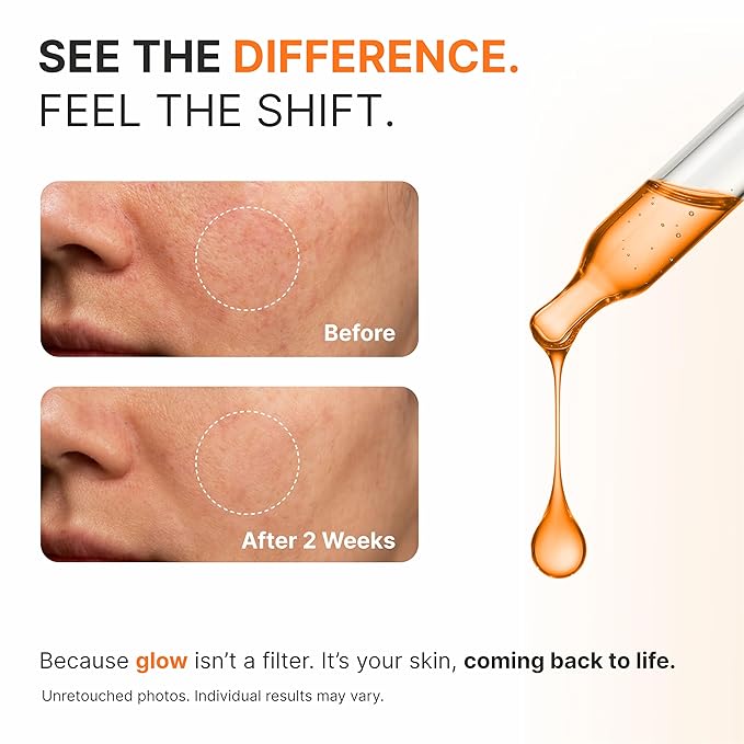 Glow Elixir | Advanced Vitamin C Serum for Face | Dark Spot Corrector with Niacinamide & Astaxanthin | Glass Skin & Brightening Serum for Even Skin Tone | Vitamin C for Face (30ml /1 Fl oz)