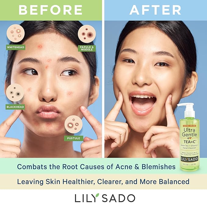 LILY SADO TEA+Cโข Green Tea & Vitamin C Face Cleanser โ Natural Vegan Antioxidant Daily Face Wash with Aloe, Rosehip, Meadowfoam - Gentle Deep Cleansing for Acne, Blackheads, Blemishes. 8 oz