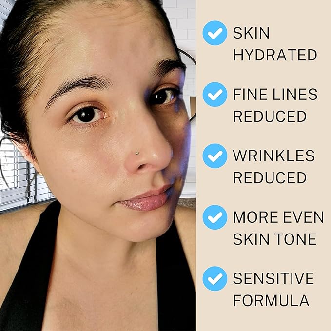 SKIN AURA Advanced Anti-Aging Serum - All-In-One Plant Derivative Formula Improves Wrinkles, Fine Lines & Age Spots with 5 Vitamins + Minerals, Hyaluronic Acid & Collagen Peptides - 30ml (1oz)