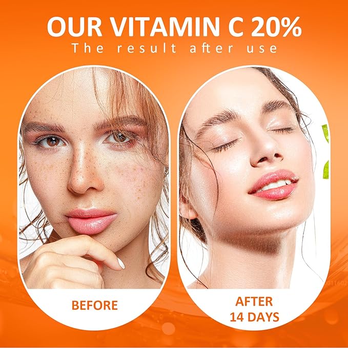 Vitamin C Facial Serum 20%, Anti-Aging Vitamin C Serum with Hyaluronic Acid and Vitamin E, Suitable for Lightening Pigmentation and Effectively Reducing Fine Lines and Wrinkles Serum 60ml,2.03Fl.Oz