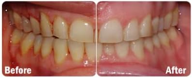 ProBiora Oral-Care Chewable Probiotic Tablets | Probiotic Supplement for Women & Men | Healthier Teeth & Gums | Fresher Breath | Whiter Teeth | Better Overall Health | 30 Count | Pack of 3 | Mint