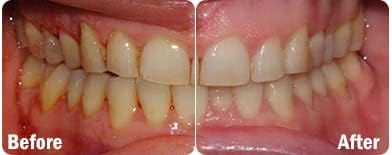 ProBiora Oral-Care Chewable Probiotic Tablets | Probiotic Supplement for Women & Men | Healthier Teeth & Gums | Fresher Breath | Whiter Teeth | 30 Count | Pack of 2 | Orange