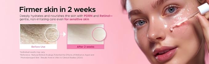 ITFU Blending Collagen UpTox Ampoule | Korean Skincare Secret, Face Serum with Salmon PDRN, Retinol & Retinal for Anti-Aging, Wrinkles, Fine Lines, Smile Lines & Lip Wrinkles, 1.01 oz / 30ml