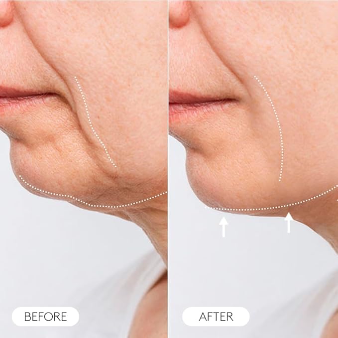 COCUNAT - CLINICAL MOLECULAR THERAPY - Anti Wrinkle Face Cream - Anti Aging Treatment - Daily Facial Moisturizer - Firms, Tightens, Restores - Menopause Skincare - 50 ml