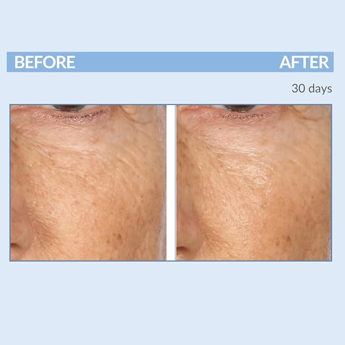 Serious Skincare Retinol Cream For Face - Vitamin A Cream XR Premium Moisturizer - Anti-Aging - Day & Night - Reduce Fine Lines & Wrinkles - For Radiant Skin 2 Fl. Oz.